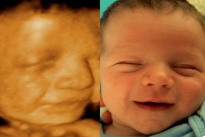 Before & After Photo Gallery