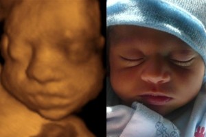 Before & After Photo Gallery