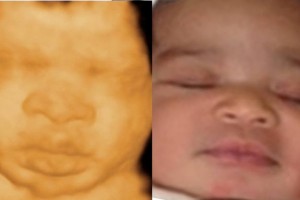 Before & After Photo Gallery