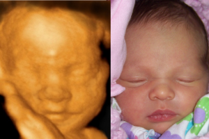Before & After Photo Gallery