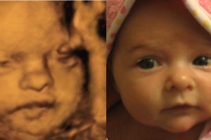 Before & After Photo Gallery
