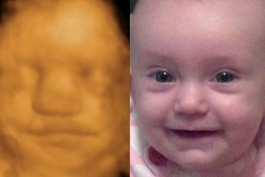 Before & After Photo Gallery
