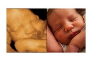 Before & After Photo Gallery