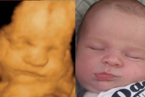 Before & After Photo Gallery