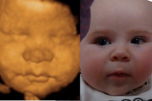 Before & After Photo Gallery