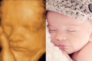 Before & After Photo Gallery