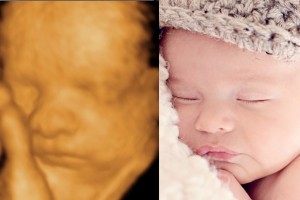 Before & After Photo Gallery