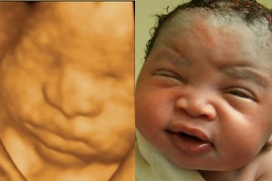 Before & After Photo Gallery