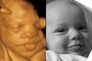Before & After Photo Gallery