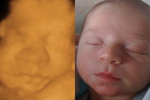 Before & After Photo Gallery