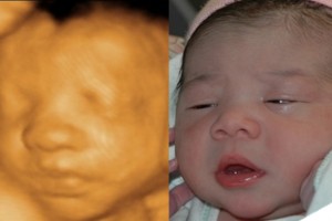 Before & After Photo Gallery