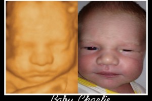 Before & After Photo Gallery