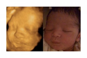 Before & After Photo Gallery