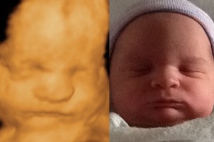 Before & After Photo Gallery