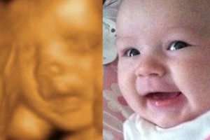 Before & After Photo Gallery
