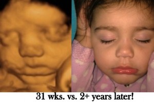 Before & After Photo Gallery