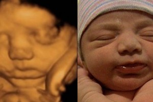 Before & After Photo Gallery