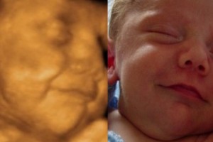 Before & After Photo Gallery