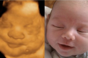 Before & After Photo Gallery