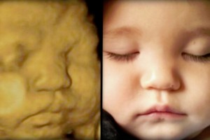 Before & After Photo Gallery