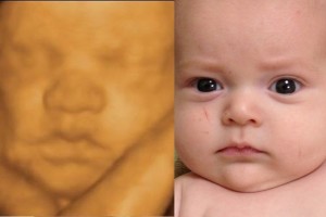 Before & After Photo Gallery
