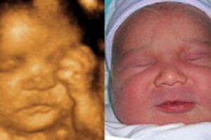 Before & After Photo Gallery