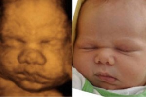 Before & After Photo Gallery