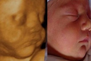 Before & After Photo Gallery