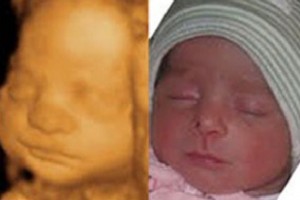 Before & After Photo Gallery