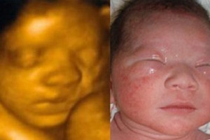 Before & After Photo Gallery