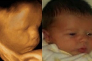 Before & After Photo Gallery