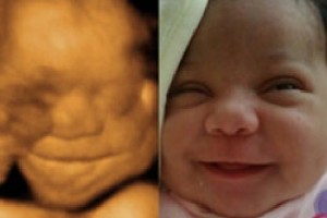 Before & After Photo Gallery