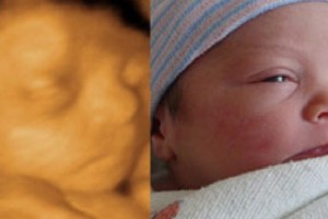 Before & After Photo Gallery