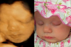 Before & After Photo Gallery