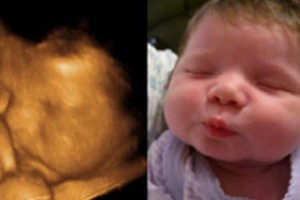 Before & After Photo Gallery