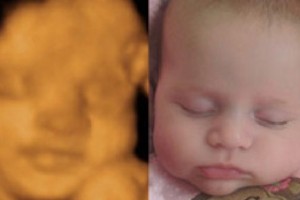 Before & After Photo Gallery