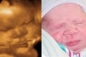 Before & After Photo Gallery