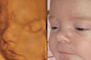 Before & After Photo Gallery