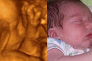Before & After Photo Gallery