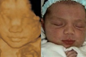 Before & After Photo Gallery