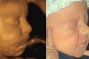 Before & After Photo Gallery