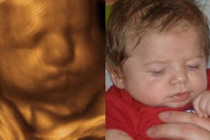 Before & After Photo Gallery