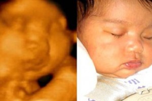 Before & After Photo Gallery