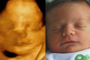 Before & After Photo Gallery