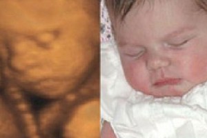 Before & After Photo Gallery