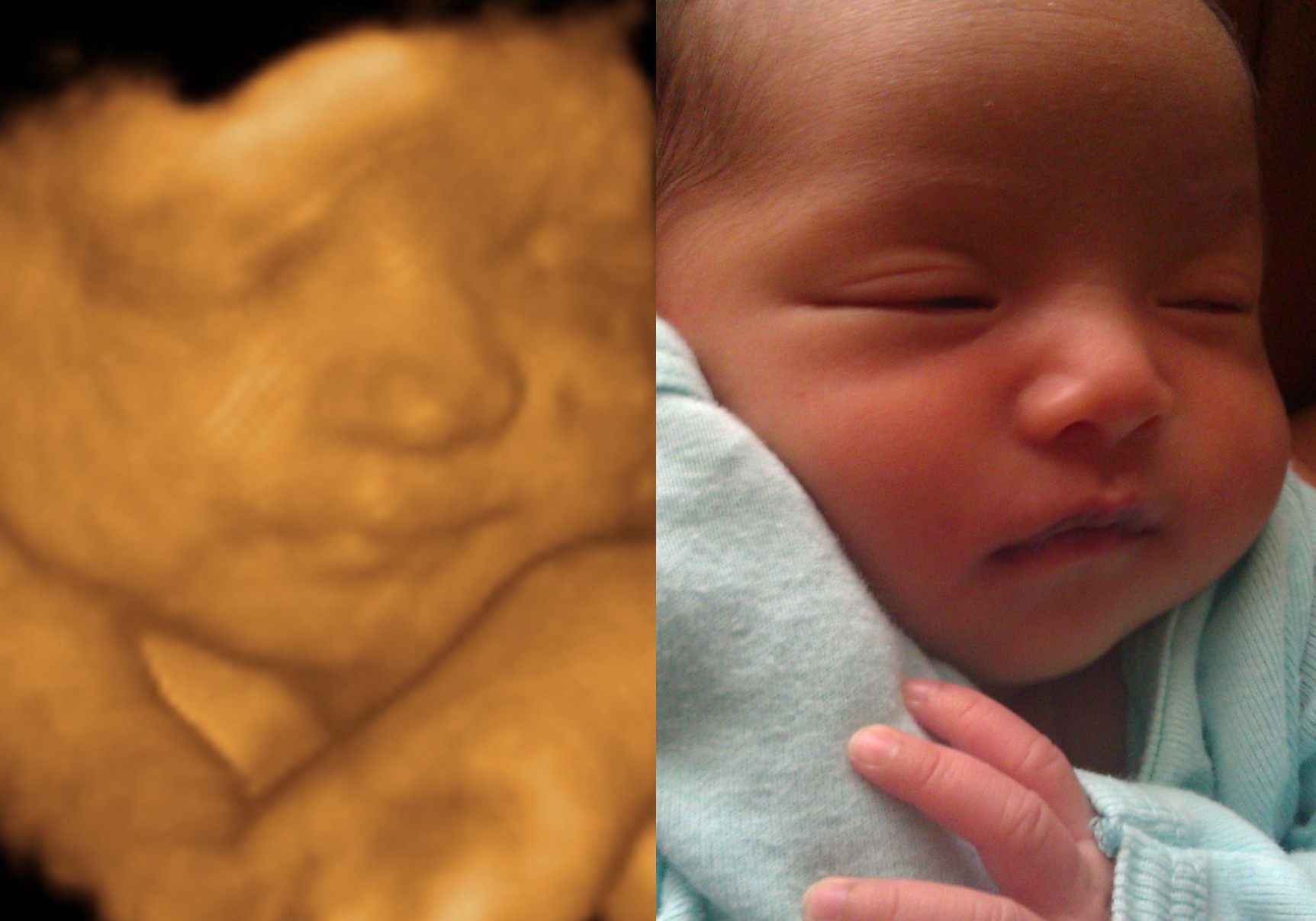 3d vs 4d ultrasounds