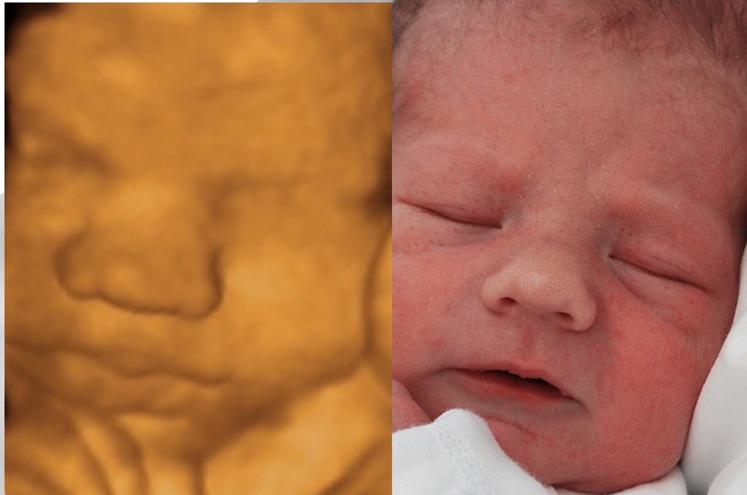 3D Ultrasound & Baby 3D 4D HD Ultrasound Virginia