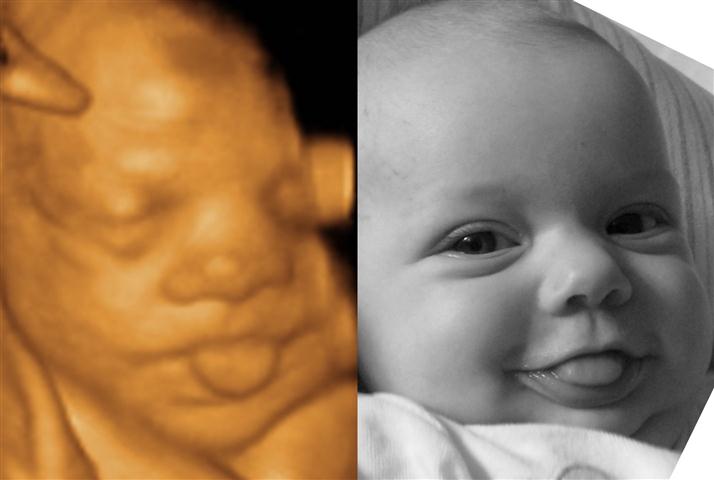 3D Ultrasound & Baby