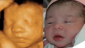 3D Ultrasound & Baby