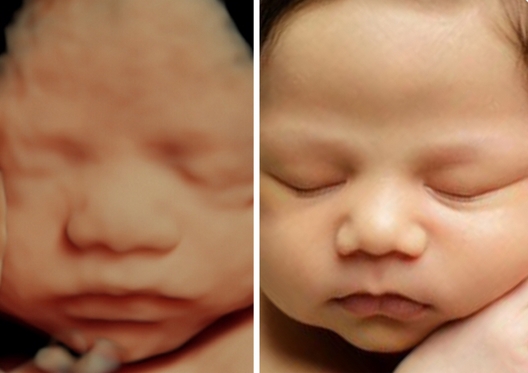 3d vs 4d baby ultrasound